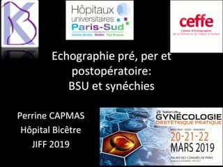 Échographie pré-, per- et postopératoire pour les synéchies et bandelettes sous-urétrales (BSU)