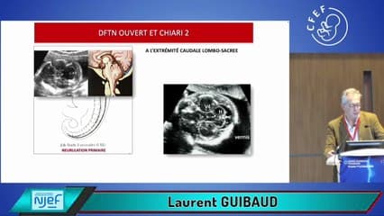 Quand le cerveau entre en dialogue avec la moelle