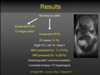 IRM du rein foetal  ( en ANGLAIS )