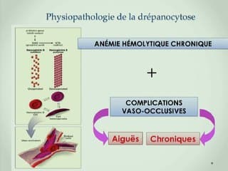 Retentissement foetal des hémoglobinopathies