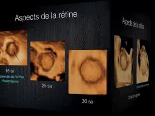 Fond d’oeil virtuel