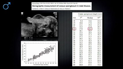 Quelle conduite donner à l’examen échographique devant un aspect inhabituel des organes génitaux externes