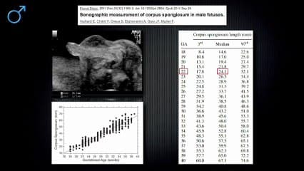 Quelle conduite donner à l’examen échographique devant un aspect inhabituel des organes génitaux externes