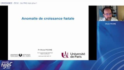 RCIU : les PAG ne nous font pas rire…