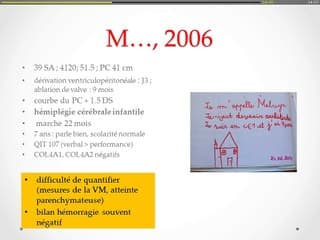 Ventriculomégalies Le suivi post-natal