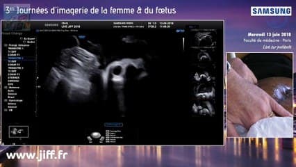 Imagerie de la face et des fentes et recommandations de la CNEOF