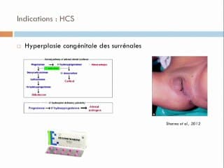 Détermination non invasive du sexe et du groupe rhésus fœtaux. Reste- t-il une place pour l’échographie ?