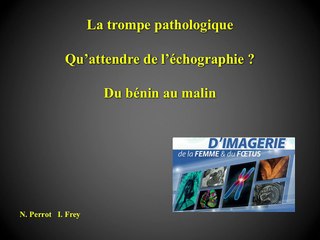 La trompe pathologique ? Qu'attendre de l'échographie, du bénin au malin