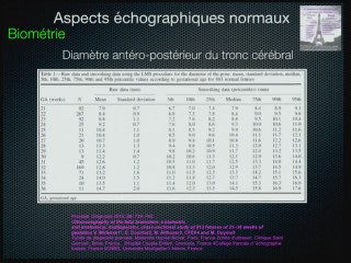 échographie de la fosse posterieure