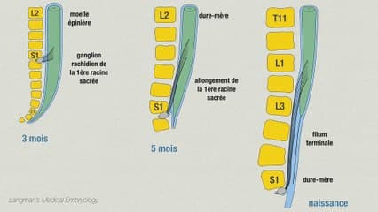 Recommandations CNEOF 2016 : ? Canal médullaire : quelles pathologies peut-on dépister ?
