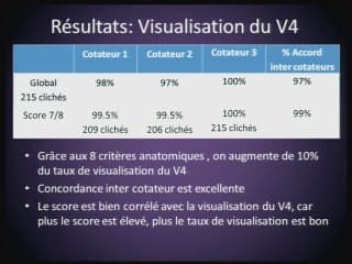 Visualisation du 4eme ventricule au premier trimestre : mythe ou outil de dépistage ?