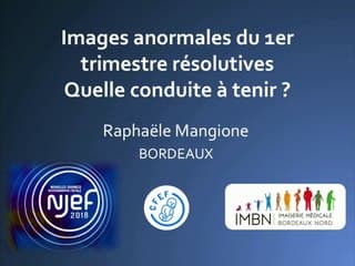 Images anormales résolutives du 1er trimestre : quelle conduite à tenir ?