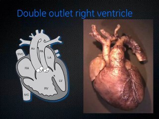 Le coeur foetal