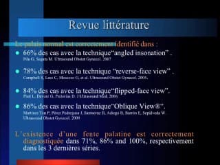 Quoi de neuf au palais ?