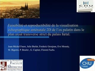 52 Aide à la visualisation échographique anténatale du palais foetal en mode 2D et 3D. Faisabilité et reproductibilité d'une méthode utilisant un score écho-anatomique en imagerie 2D.