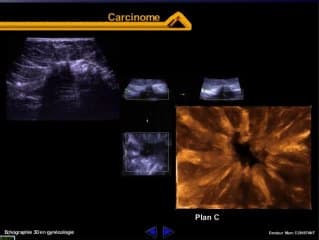 La gynécologie et la pathologie mammaire