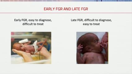 CROISSANCE ET BIEN-ÊTRE DU FŒTUS : Quel paramètre biométrique est pertinent pour apprécier la croissance fœtale ?