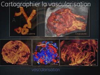 La place de l'échographie 3D en gynécologie-obstétrique Le pour