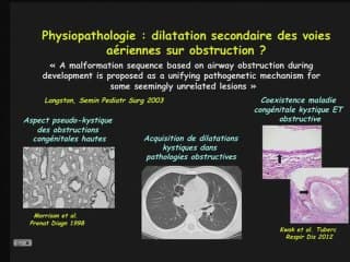 La formation du poumon foetal : principales étapes et pathologies