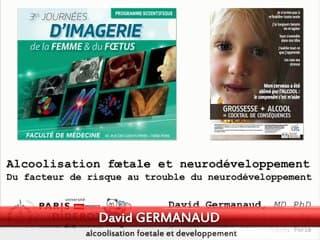 alcoolisation fœtale et développement