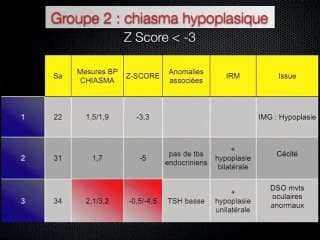 Biométrie du chiasma : un outil pronostique ?