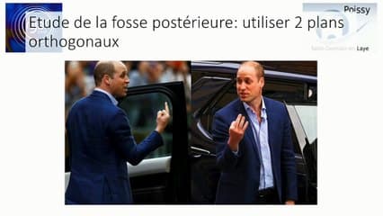 Cerveau foetal II : c’est trop gros ! Méga grande citerne