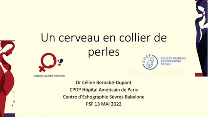 Analyse des images anéchogènes cérébrales à partir d'un cas clinique