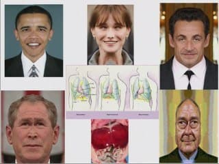 Le situs et ses pathologies