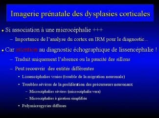 Le cortex dans tous ses états