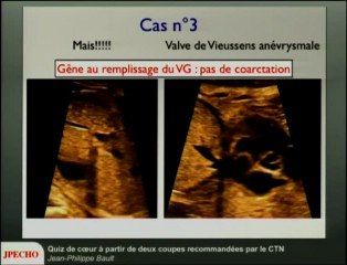 Quiz de coeur à partir de deux coupes recommandées par le CTN