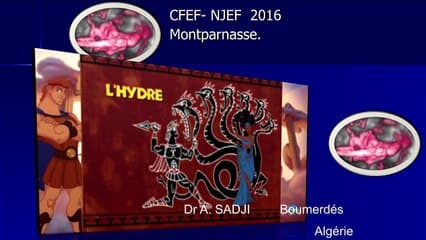 anevrysme de la veine de Galien