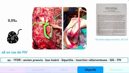 L’échographie T3 est-elle vraiment utile ?