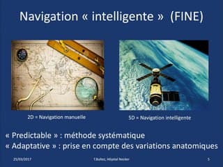 COEUR PERSPECTIVE : ANALYSE AUTOMATIQUE : L’ÉCHOGRAPHISTE VA T-IL DISPARAITRE ?