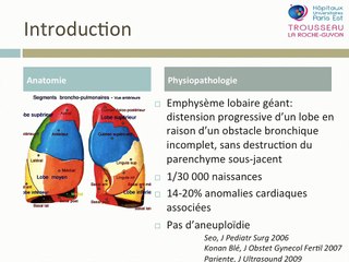 Emphysème lobaire géant