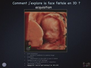 POSTER 3D Surface