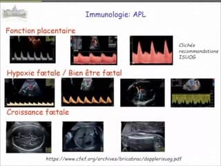 Pathologie maternelle et imagerie fœtale