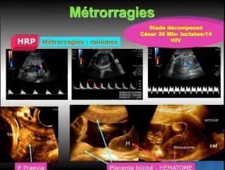 Échographie à Saint-Laurent du Maroni