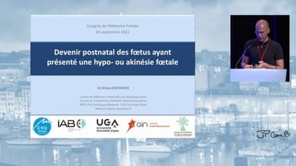 Devenir Postnatal des fœtus ayant présenté une hypo et akinésie fœtale