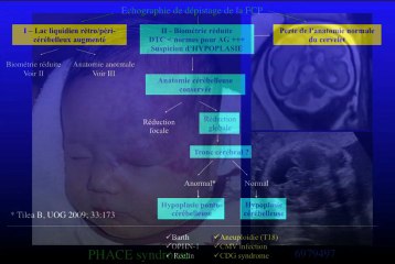 le cerveau fœtal