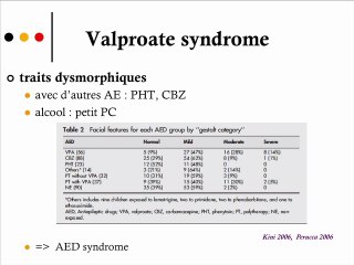 Dépakine : Le Valproate Syndrome ou il n’y a pas que les malformations du tube neural…