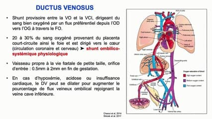 Agénésies du ductus venosus isolées, faut-il faire un DPN ?