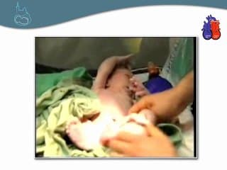 Et si on vous montrait la suite ? Transposition des gros vaisseaux