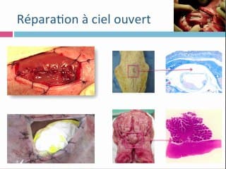 Prise en charge anténatale future