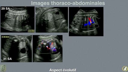 Images thoraco-abdominales : vous avez dit bizarre ?