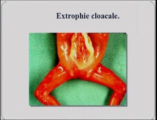 Appareil urinaire normal et pathologique