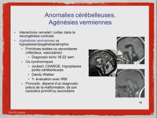 Implications d’un diagnostic exact pour la prise en charge post natale