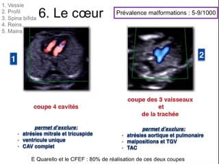 Ce n'est pas si difficile !.