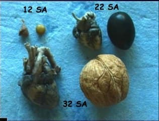 Les quatre cavités de l’embryologie à l’anatomie