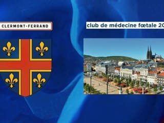 42 Démarche diagnostique anténatale devant une anomalie complexe des OGE fœtaux (à propos d'un cas)