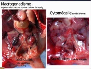 Inversion péricentrique CH11, mégavessie